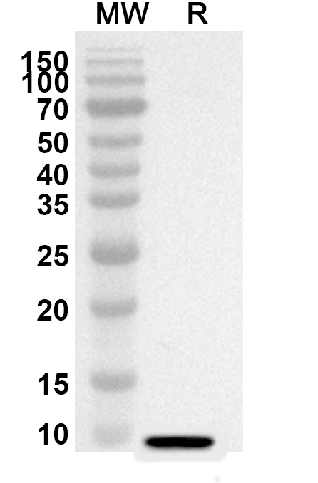 Anti-Human LRP5 Polyclonal Antibody binds to Human LRP5 Recombinant Protein, C-His in WB Assay