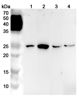 Anti-Human LYPLA1 Polyclonal Antibody binds to Recombinant Human LYPLA1 Protein, N-His in WB Assay