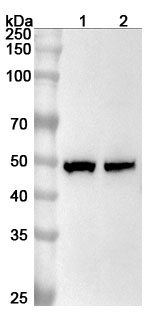 Anti-Human MBD2 Polyclonal Antibody binds to Recombinant Human MBD2, N-His in WB Assay