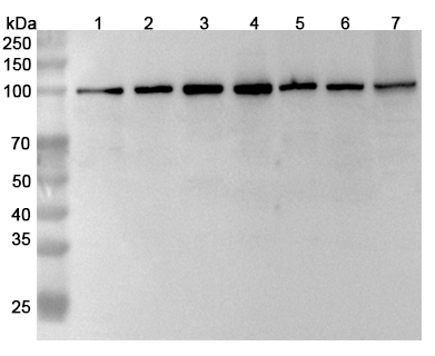 Anti-Human MCM6 Polyclonal Antibody binds to Recombinant Human MCM6 Protein, N-His in WB Assay