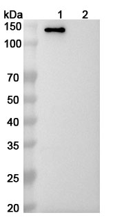 Anti-Human MDA5/IFIH1 Antibody (SAA2313) binds to Human MDA5 recombinant protein in WB Assay