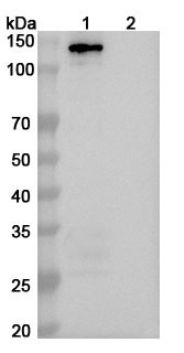 Anti-Human MDA5/IFIH1 Antibody (SAA2314) binds to Human MDA5 recombinant protein in WB Assay