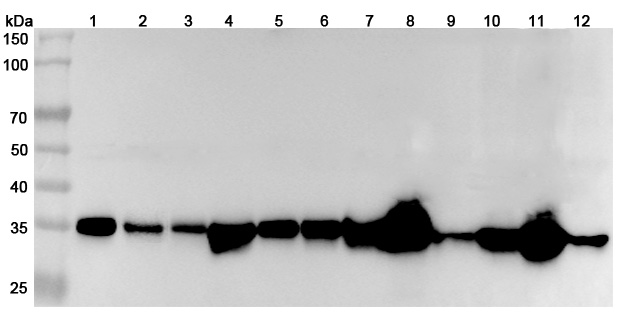 Anti-Human MDH2 Polyclonal Antibody binds to Recombinant Human MDH2 Protein, N-His in WB Assay