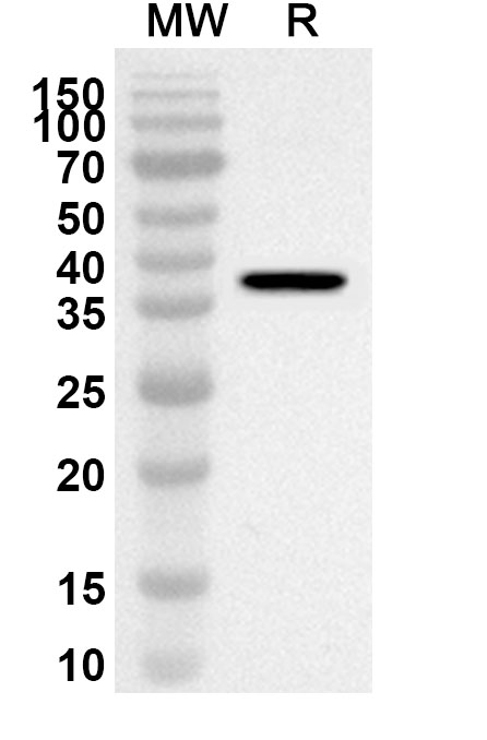 Anti-Human MECR Polyclonal Antibody binds to Recombinant Human MECR Protein, N-His in WB Assay