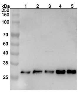 Anti-Human MED7 Polyclonal Antibody binds to Recombinant Human MED7 Protein, N-His in WB Assay