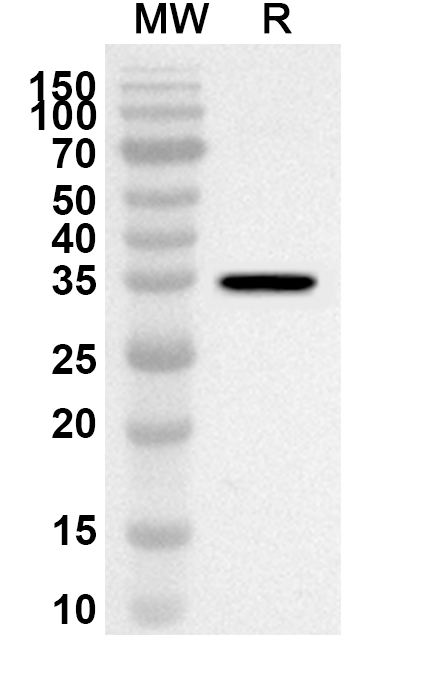 Anti-Human MET/c-Met/HGFR Polyclonal Antibody binds to Human MET recombinant protein in WB Assay