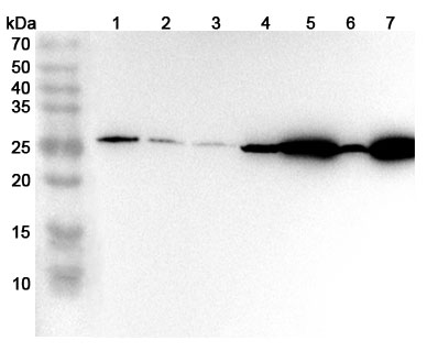 Anti-Human MGST1 Polyclonal Antibody binds to Recombinant Human MGST1 Protein, N-His in WB Assay