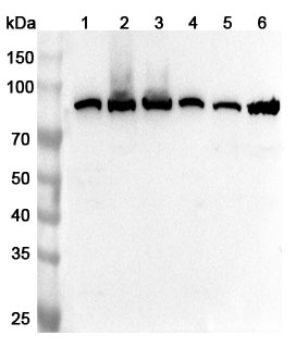 Anti-Human MMUT Polyclonal Antibody binds to Recombinant Human MMUT Protein, N-His in WB Assay