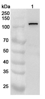 Anti-Human MPHOSPH10 Polyclonal Antibody binds to Recombinant Human MPHOSPH10 Protein, N-His in WB Assay