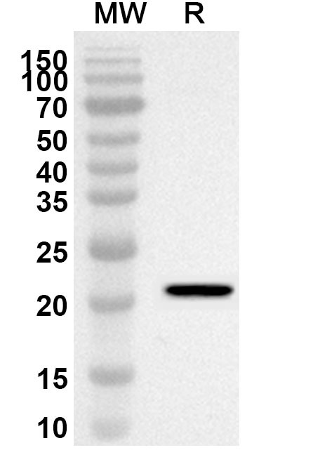 Anti-Human MRPL11 Polyclonal Antibody binds to Recombinant Human MRPL11 Protein, N-His in WB Assay
