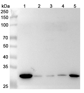 Anti-Human MTAP Polyclonal Antibody binds to Recombinant Human MTAP Protein, N-His in WB Assay