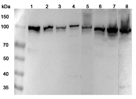Anti-Human MTHFD1 Polyclonal Antibody binds to Recombinant Human MTHFD1 Protein, N-His in WB Assay