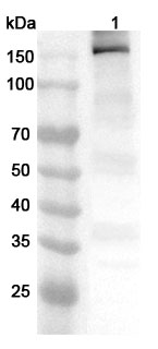 Anti-Human MYBPC3 Polyclonal Antibody binds to Recombinant Human MYBPC3 Protein, N-His in WB Assay