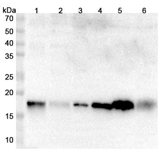 Anti-Human MYL9 Polyclonal Antibody binds to Recombinant Human MYL9, N-His in WB Assay