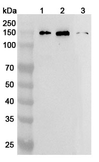 Anti-Human MYPN Polyclonal Antibody binds to Recombinant Human MYPN Protein, N-His in WB Assay