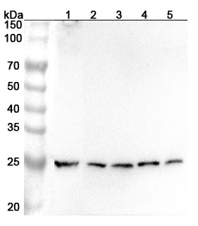 Anti-Human NAXE Polyclonal Antibody binds to Recombinant Human NAXE Protein, N-His in WB Assay