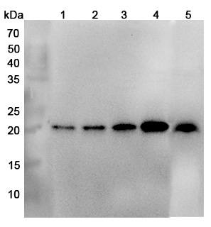 Anti-Human NDUFB10 Polyclonal Antibody binds to Recombinant Human NDUFB10 Protein, N-His in WB Assay