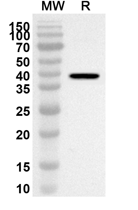 Anti-Human NDUFB5 Polyclonal Antibody binds to Recombinant Human NDUFB5 Protein, N-GST & C-His in WB Assay