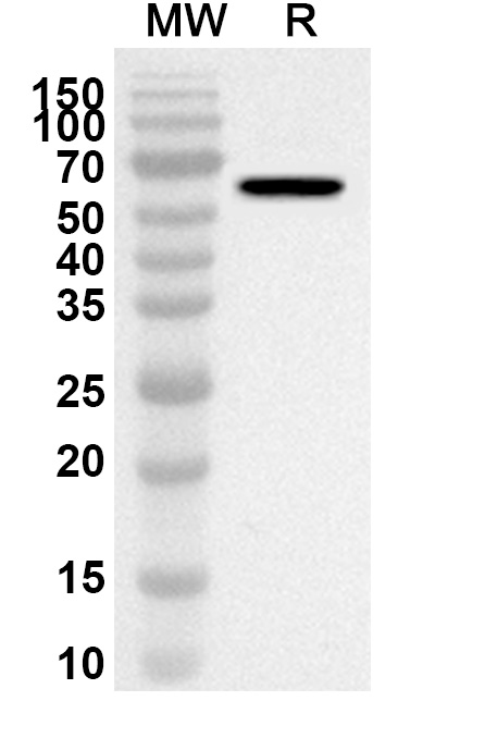 Anti-Human NEU3/Sialidase-3 Polyclonal Antibody binds to Recombinant Human NEU3/Sialidase-3 Protein, C-His in WB Assay