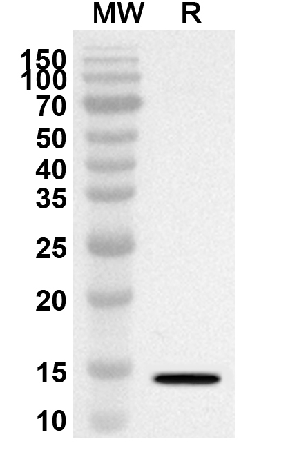 Anti-Human OIP5 Polyclonal Antibody binds to Recombinant Human OIP5 Protein, N-His in WB Assay