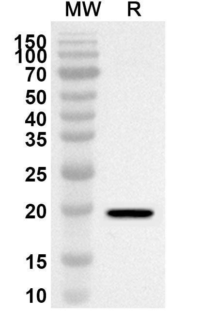 Anti-Human ORAI2 Polyclonal Antibody binds to Human ORAI2 Recombinant Protein, N-GST & C-His in WB Assay