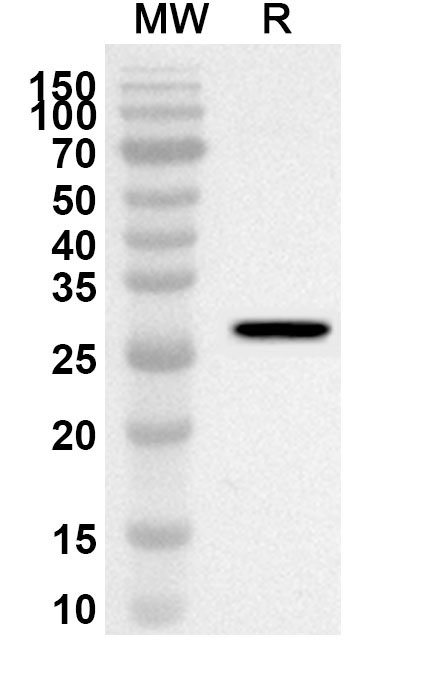 Anti-Human OS9 Polyclonal Antibody binds to Recombinant Human OS9 Protein, N-His in WB Assay