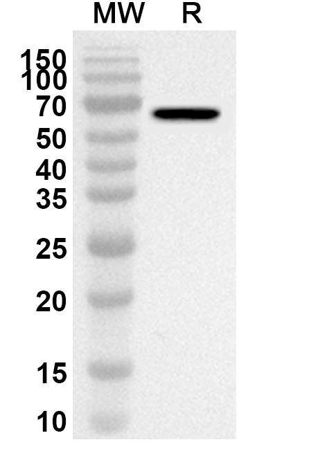 Anti-Human OTUD1 Polyclonal Antibody binds to Recombinant Human OTUD1 Protein, N-His in WB Assay