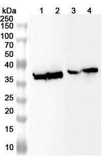 Anti-Human P2RX4 Polyclonal Antibody binds to Recombinant Human P2RX4 Protein, N-GST & C-His in WB Assay