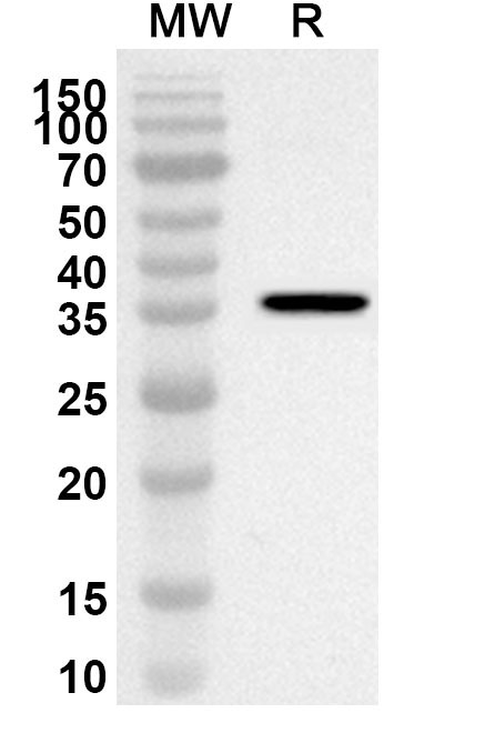 Anti-Human PDCD4/PD4 Polyclonal Antibody binds to Recombinant Human PDCD4/PD4 Protein, N-His in WB Assay
