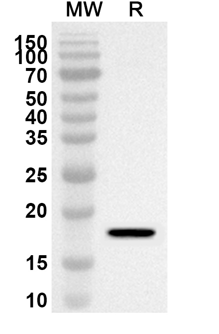 Anti-Human PDE2A Polyclonal Antibody binds to Recombinant Human PDE2A Protein, N-His in WB Assay