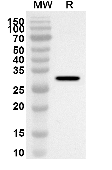 Anti-Human PDE4A Polyclonal Antibody binds to Recombinant Human PDE4A Protein, N-His in WB Assay