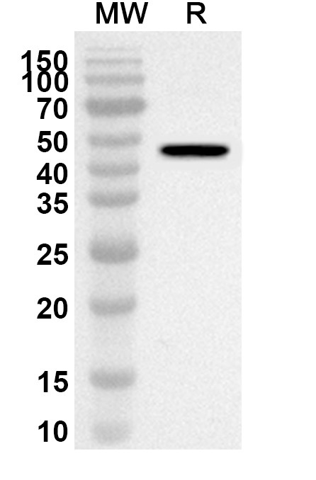 Anti-Human PDK4 Polyclonal Antibody binds to Recombinant Human PDK4 Protein, N-His in WB Assay