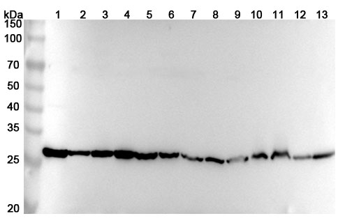 Anti-Human PGAM1 Polyclonal Antibody binds to PGAM1, N-His, recombinant protein in WB Assay