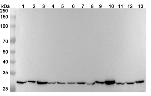 Anti-Human PGAM2 Polyclonal Antibody binds to Recombinant Human PGAM2 Protein, N-His in WB Assay