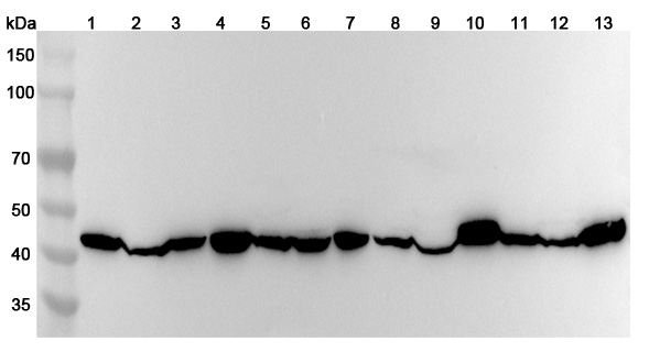 Anti-Human PGK2 Polyclonal Antibody binds to Recombinant Human PGK2 Protein, N-His in WB Assay