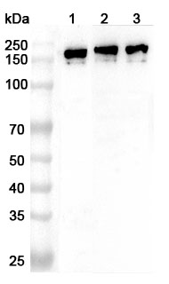 Anti-Human PLCB1 Polyclonal Antibody binds to Recombinant Human PLCB1 Protein, N-His in WB Assay