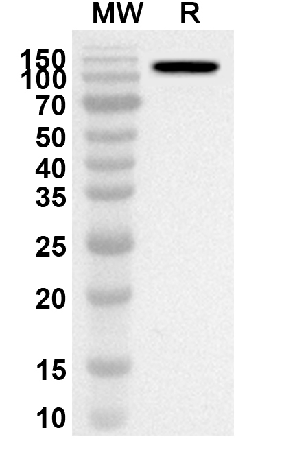 Anti-Human POLQ Polyclonal Antibody binds to Recombinant Human POLQ Protein, C-His in WB Assay