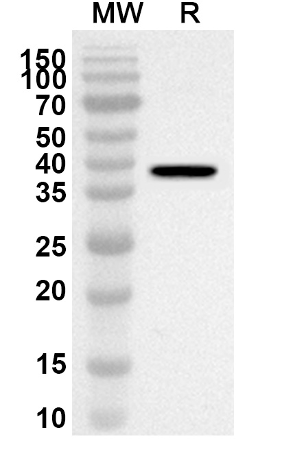 Anti-Human PPP1CC Polyclonal Antibody binds to Recombinant Human PPP1CC Protein, N-His in WB Assay