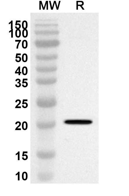 Anti-Human PPP3R2 Polyclonal Antibody binds to Recombinant Human PPP3R2 Protein, N-His in WB Assay