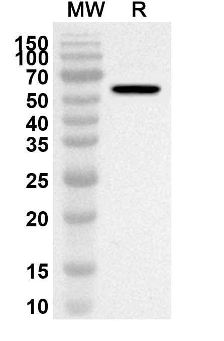 Anti-Human PPP5C Polyclonal Antibody binds to Recombinant Human PPP5C Protein, N-His in WB Assay