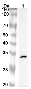 Anti-Human PRKRA Polyclonal Antibody binds to Recombinant Human PRKRA Protein, N-His in WB Assay