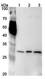 Anti-Human PSMA4 Polyclonal Antibody binds to Recombinant Human PSMA4 Protein, N-His in WB Assay