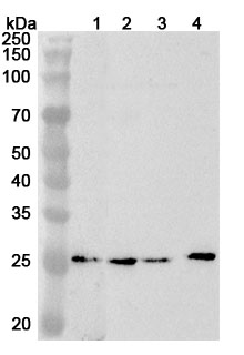 Anti-Human PSMA6 Polyclonal Antibody binds to Human PSMA6 Recombinant Protein, N-His in WB Assay