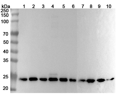 Anti-Human PSMB1 Polyclonal Antibody binds to Recombinant Human PSMB1 Protein, N-His in WB Assay