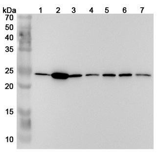 Anti-Human PSMB2 Polyclonal Antibody binds to Recombinant Human PSMB2 Protein, N-His in WB Assay