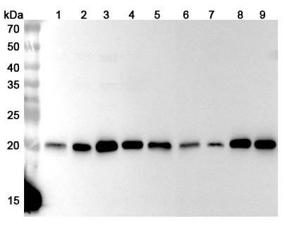 Anti-Human PSMB5 Polyclonal Antibody binds to Recombinant Human PSMB5 Protein, N-His in WB Assay