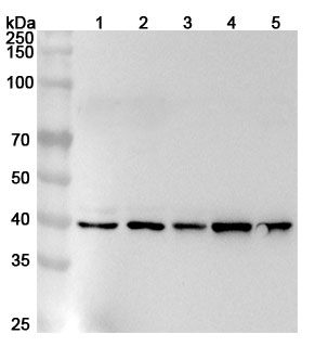 Anti-Human PSTPIP1 Polyclonal Antibody binds to Recombinant Human PSTPIP1 Protein, N-His in WB Assay