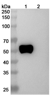 Anti-Human RAGE Antibody (XT-M4) binds to Human RAGE/AGER Recombinant Protein, C-Fc in WB Assay