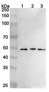 Anti-Human RARB Polyclonal Antibody binds to Recombinant Human RARB Protein, N-His in WB Assay
