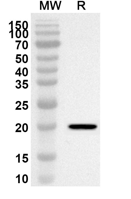 Anti-Human RASSF6 Polyclonal Antibody binds to Recombinant Human RASSF6 Protein, N-His in WB Assay